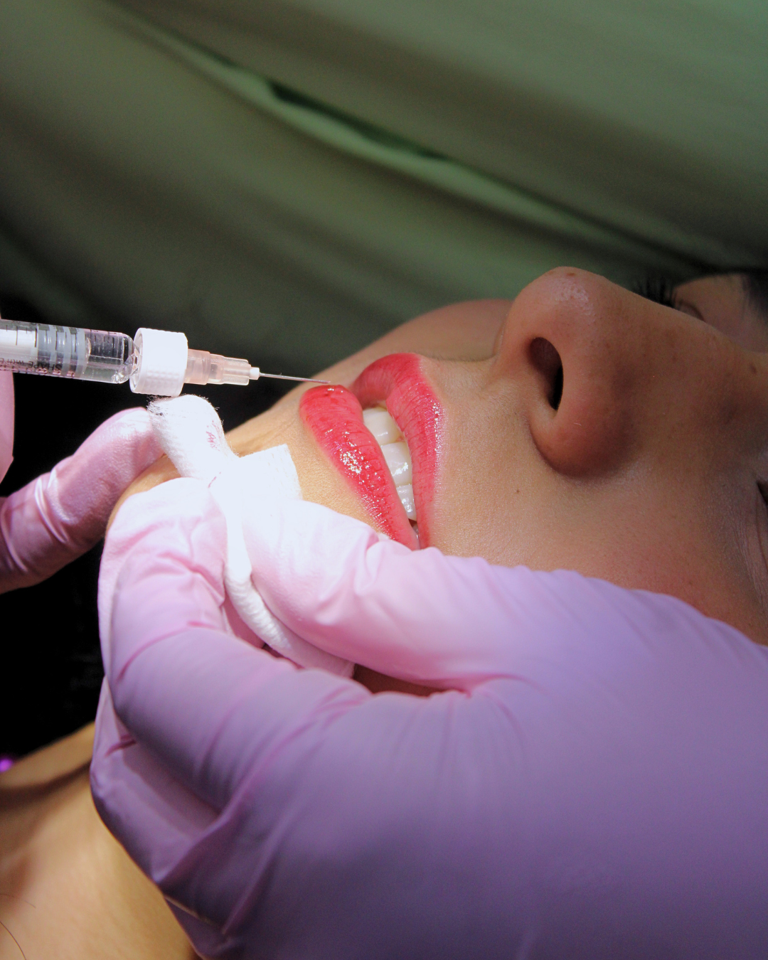 Armonización Orofacial y estética